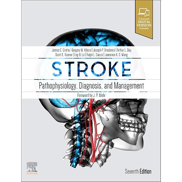 Amazon | Caplan's Stroke: A Clinical Approach | Caplan, Louis R